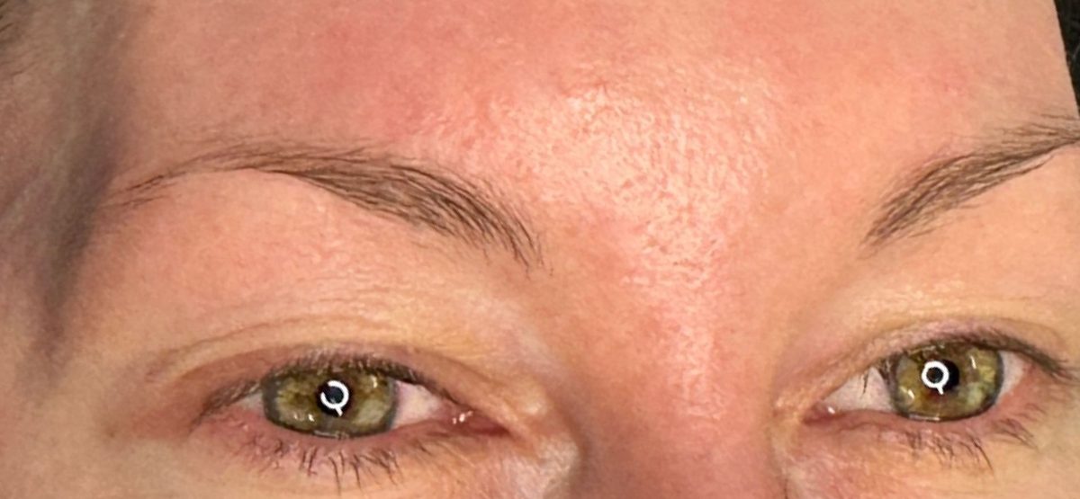 Before Corrective Work