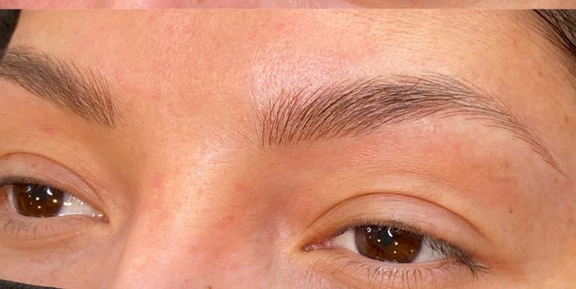 After Microblading